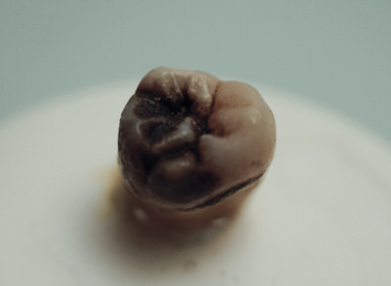 Premium Plus™ C03-C Carbolite Curing Light - noir