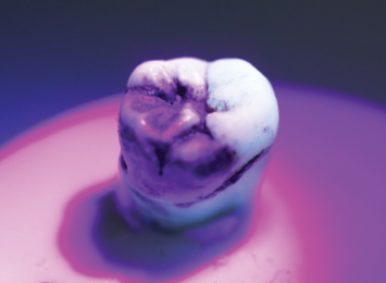 Premium Plus™ C03-C Carbolite Curing Light - noir