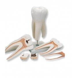 Molaire supérieure sur pied