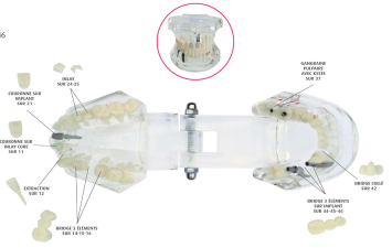 Modèle d'étude couronnes